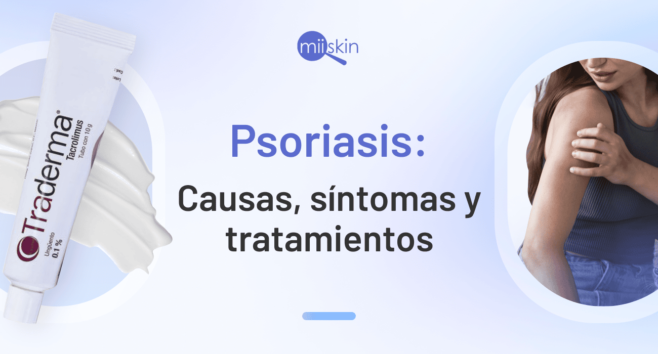 psoriasis causas