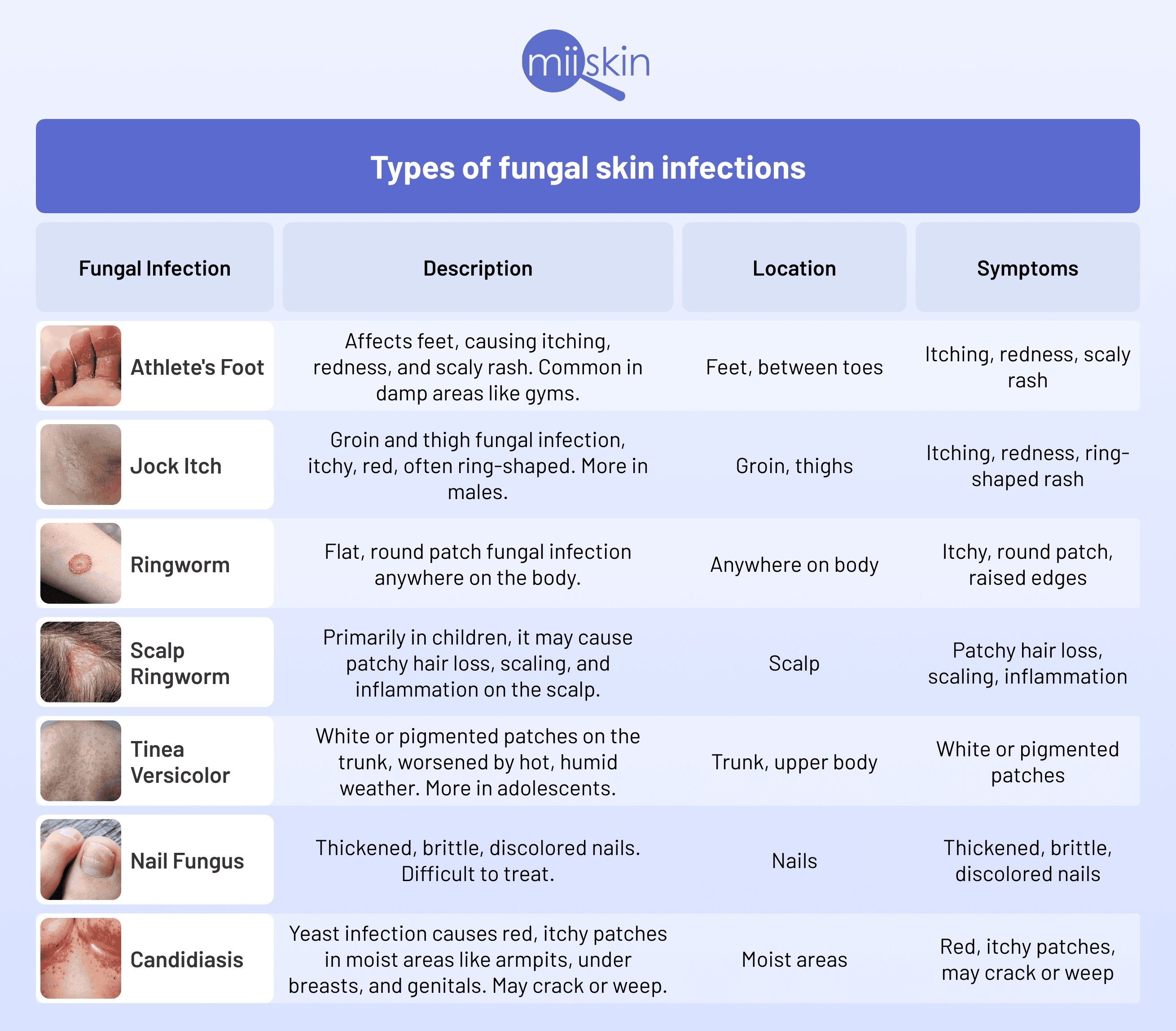 types of fungus on the skin