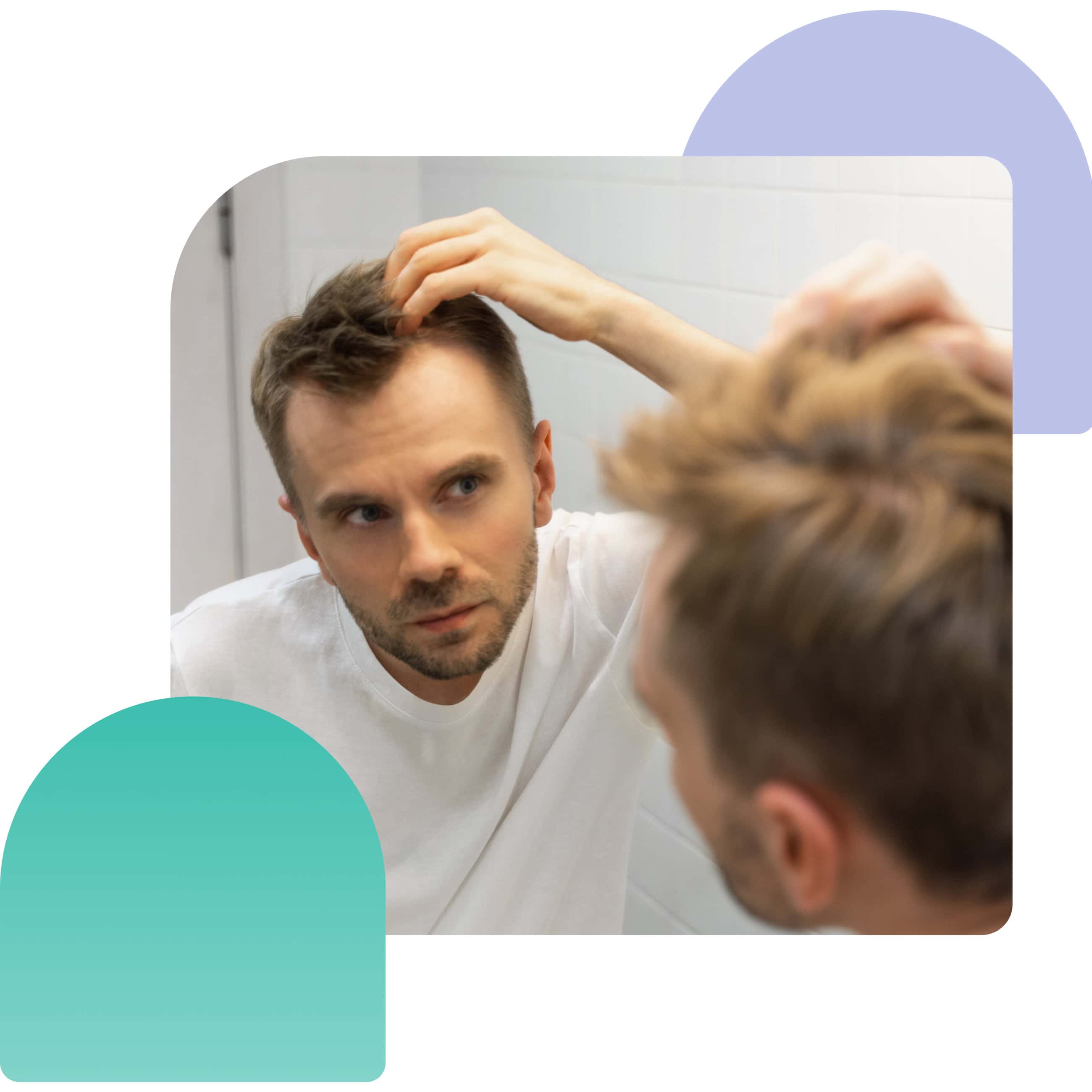 Adverse effects of using topical finasteride and minoxidil spray