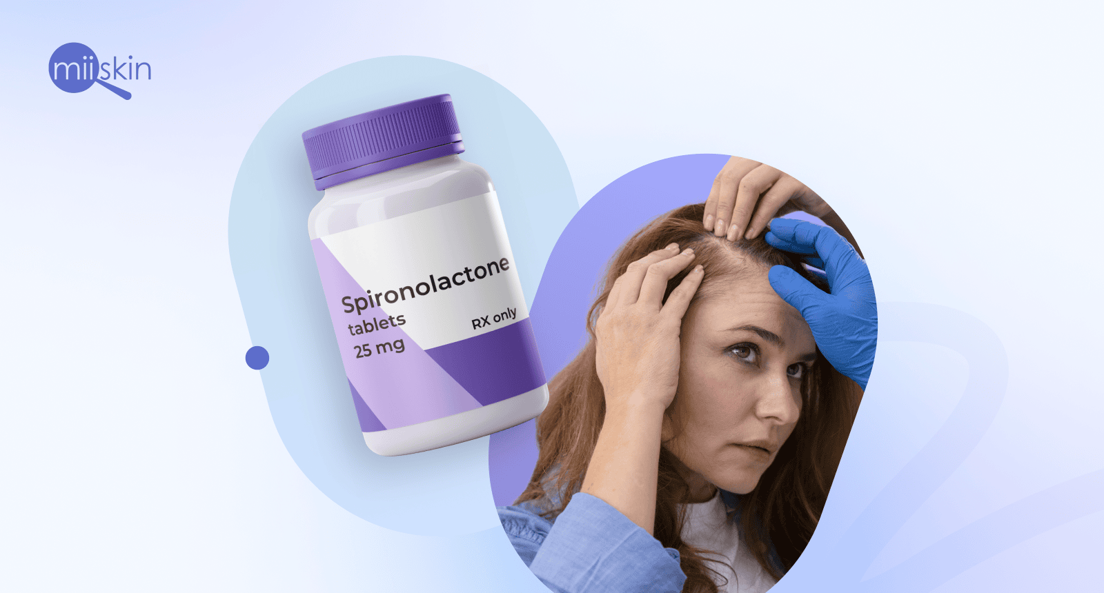 spironolactone prescription for hair loss