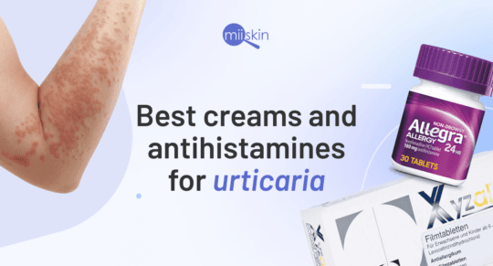 antihistamines-and-creams-for-urticaria