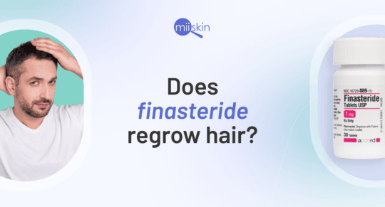 finasteride prevents hair loss