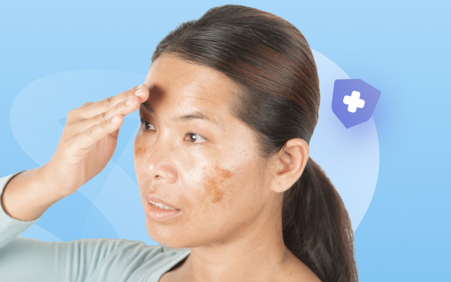 The Power of Antibiotics for Clear Skin