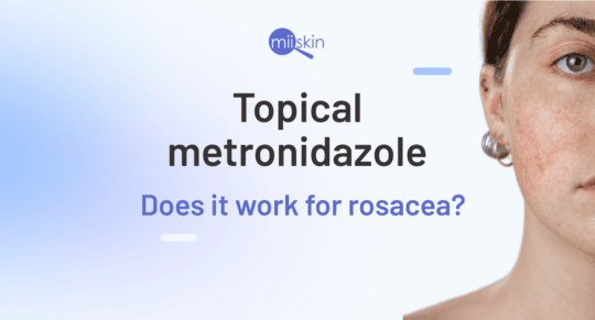 topical metronidazole for rosacea