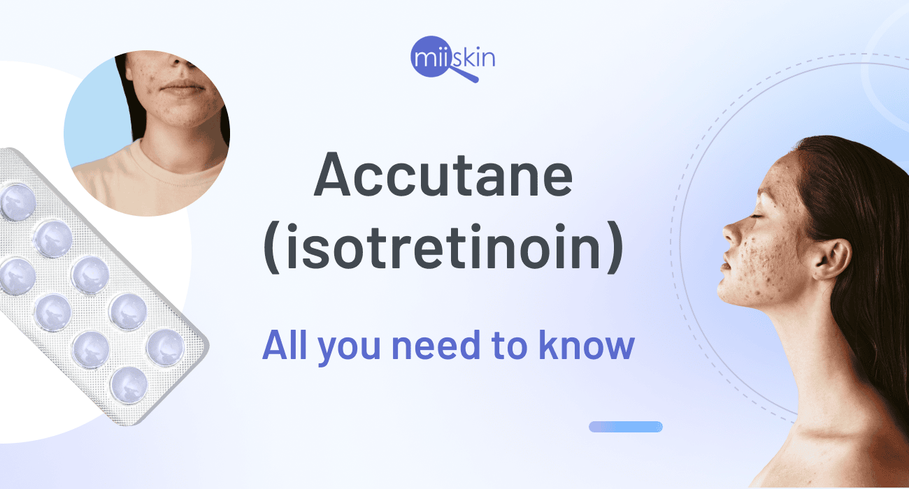 Accutane (isotretinoin): All you need to know
