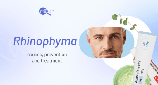rhinophyma treatment options