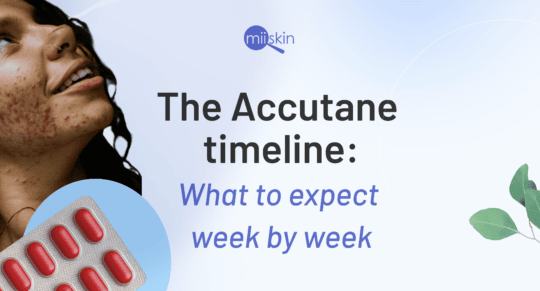 Image showing a young woman with acne looking upwards and smiling, alongside a blister pack of red capsules. Text reads "The Accutane timeline: What to expect week by week" with the Miiskin logo above. A minimal light blue background features a leaf illustration on the right.