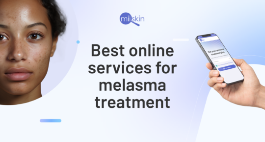 image featuring the text 'Best online services for melasma treatment'. On the left is a close-up of a woman’s face with visible melasma, and on the right, a hand holds a smartphone displaying the Miiskin treatment plan interface