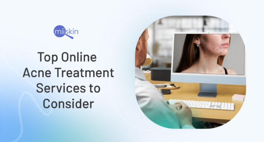 online acne treatment