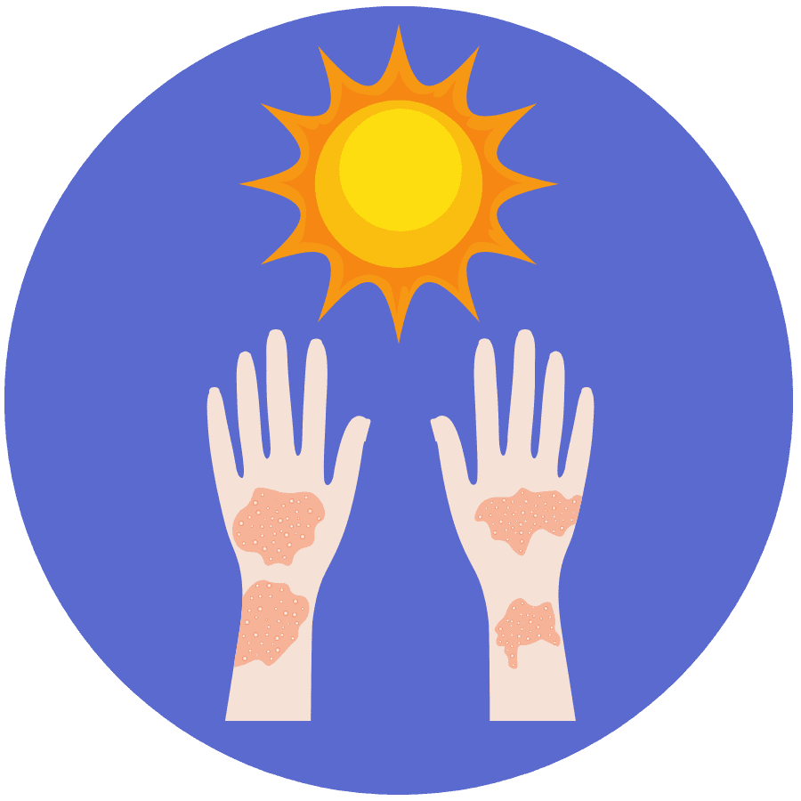 sun sensitivity