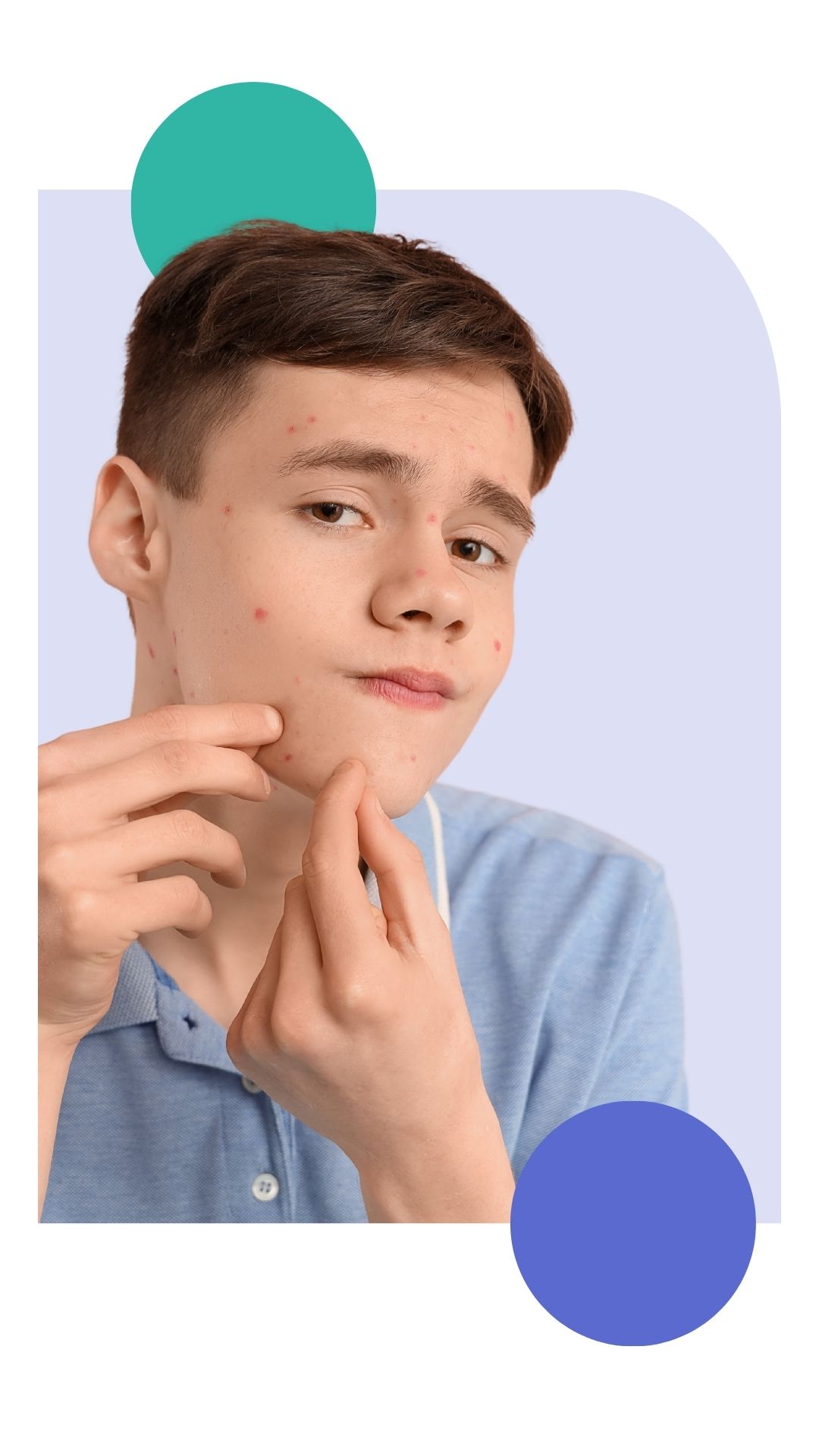 Teenager with acne examining his face and gently touching a pimple on his chin, representing common adolescent skin concerns that can be treated through Miiskin’s online dermatology care.