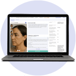 Laptop screen showing an online dermatology consultation, representing access to generic and compounded medications.