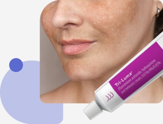 how to purchase triluma cream prescription