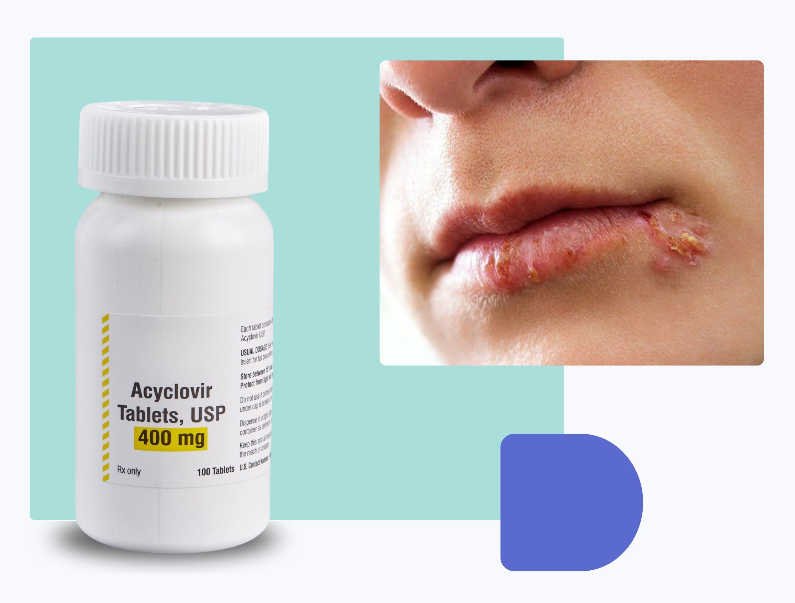 require acyclovir prescription
