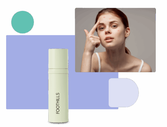 get a topical spironolactone formula