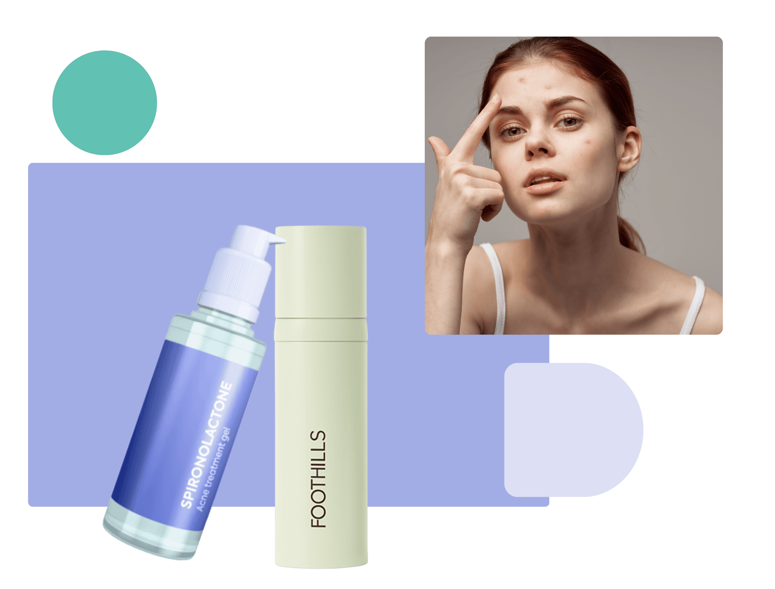 topical spironolactone for acne Woman with acne touching her forehead alongside a topical spironolactone gel and a Foothills Pharmacy skincare bottle