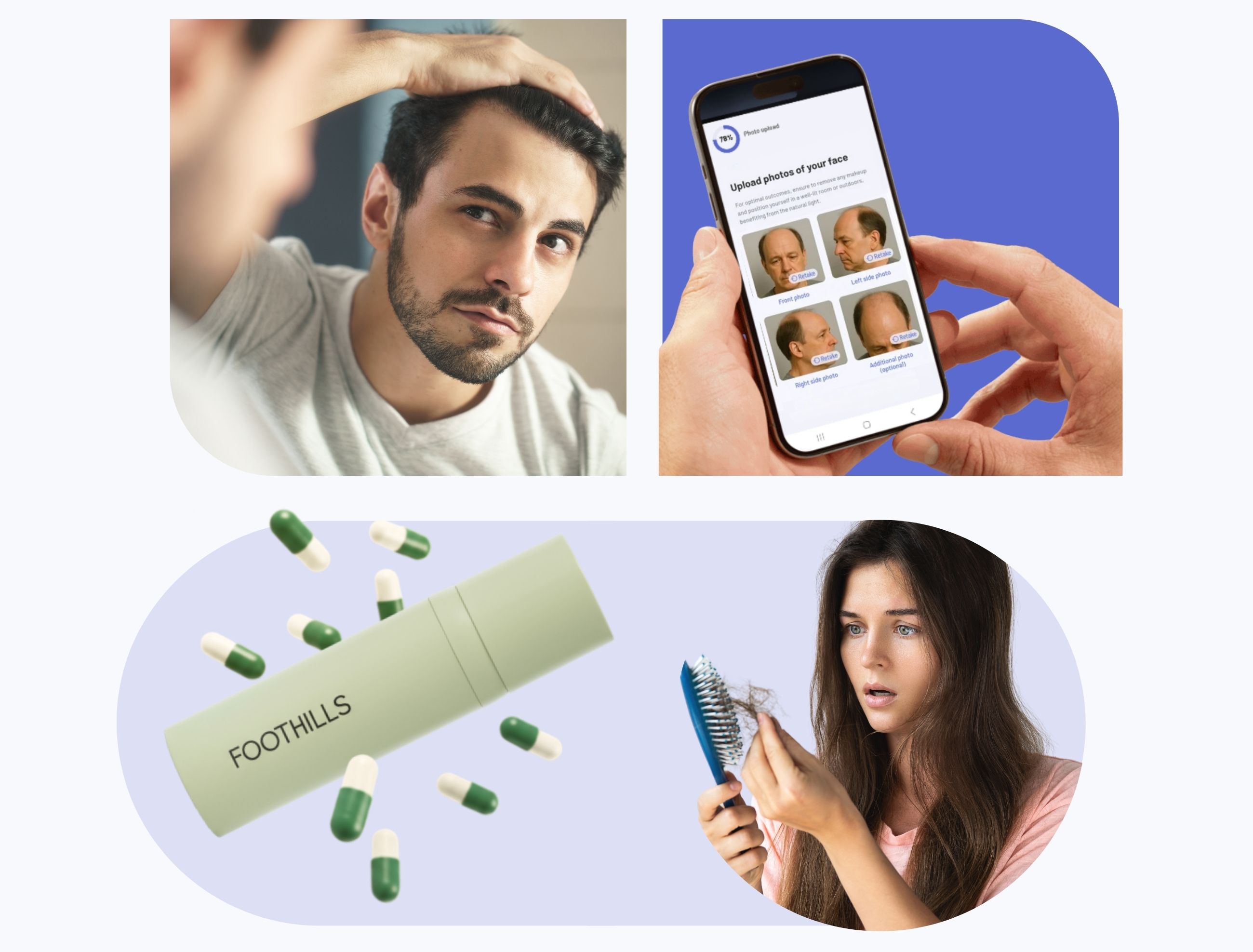 hair loss treatment online hair loss treatment