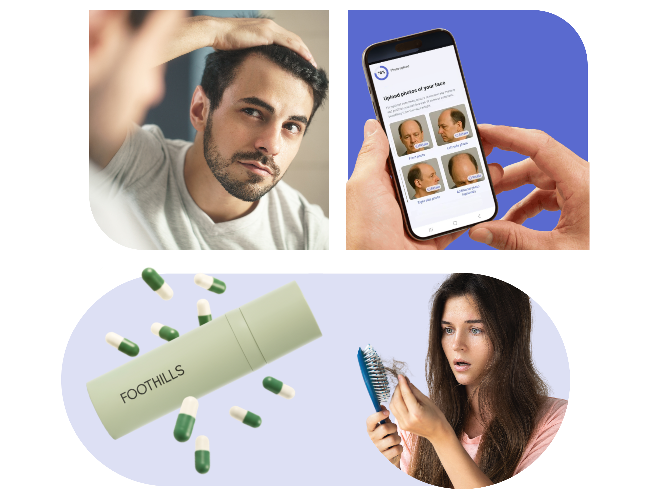 hair loss treatment online hair loss treatment