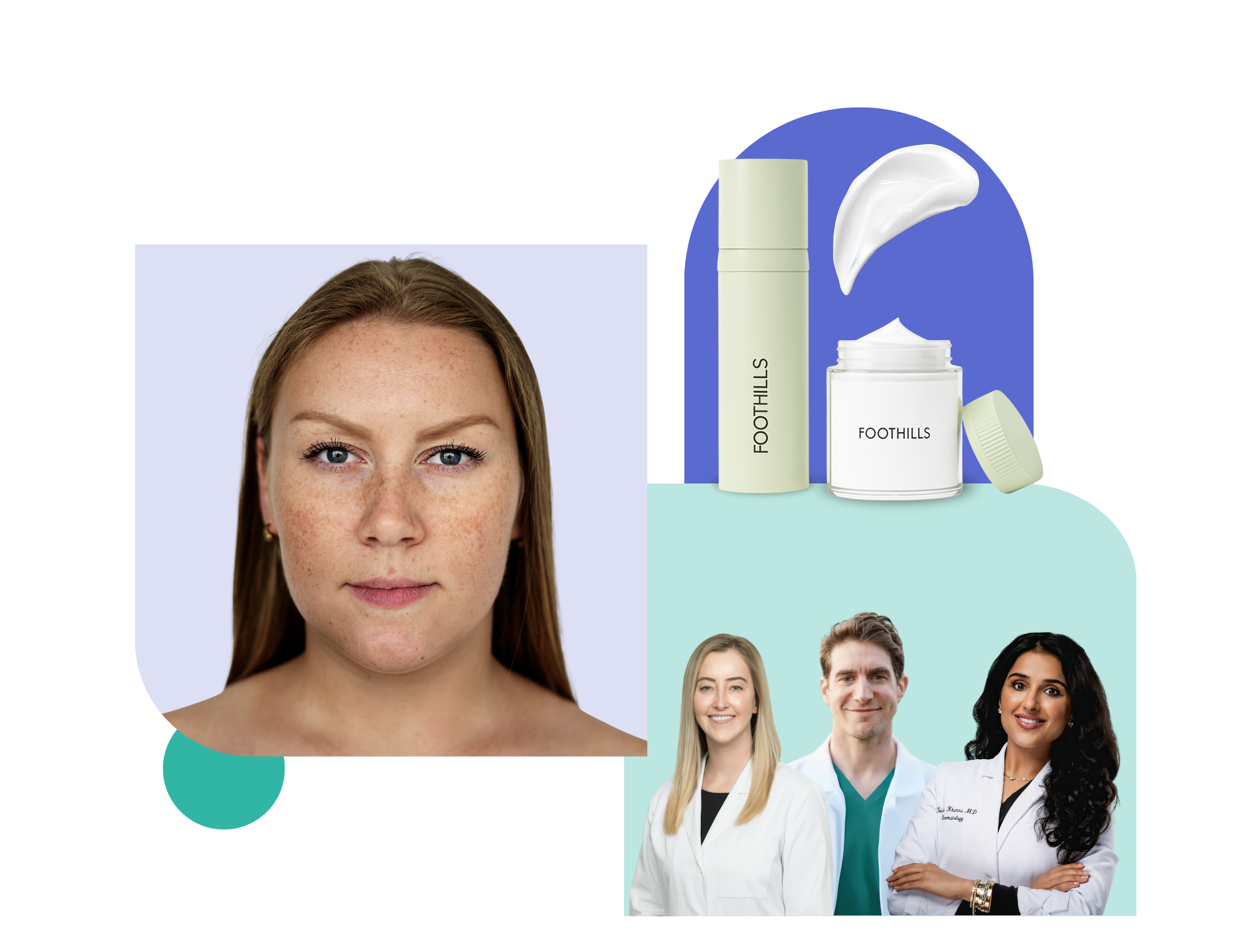 online hyperpigmentation treatment treatment of hyperpigmentation online