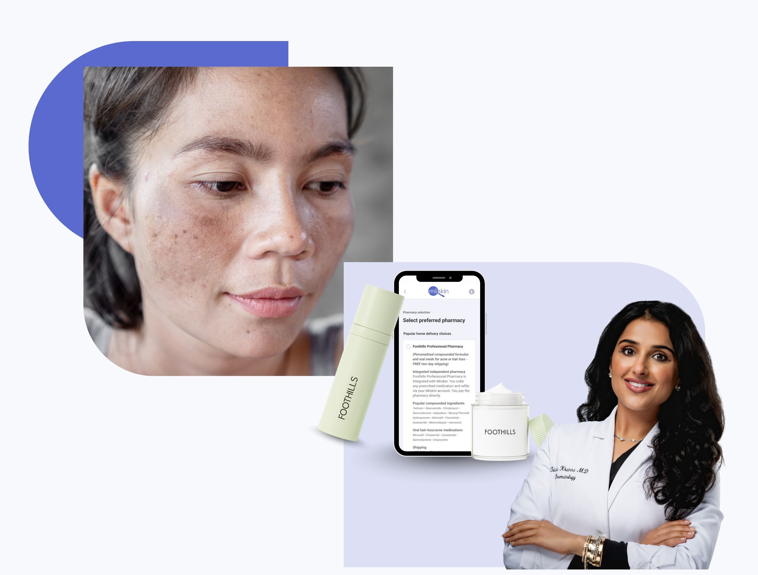 online hyperpigmentation treatment treatment of hyperpigmentation online