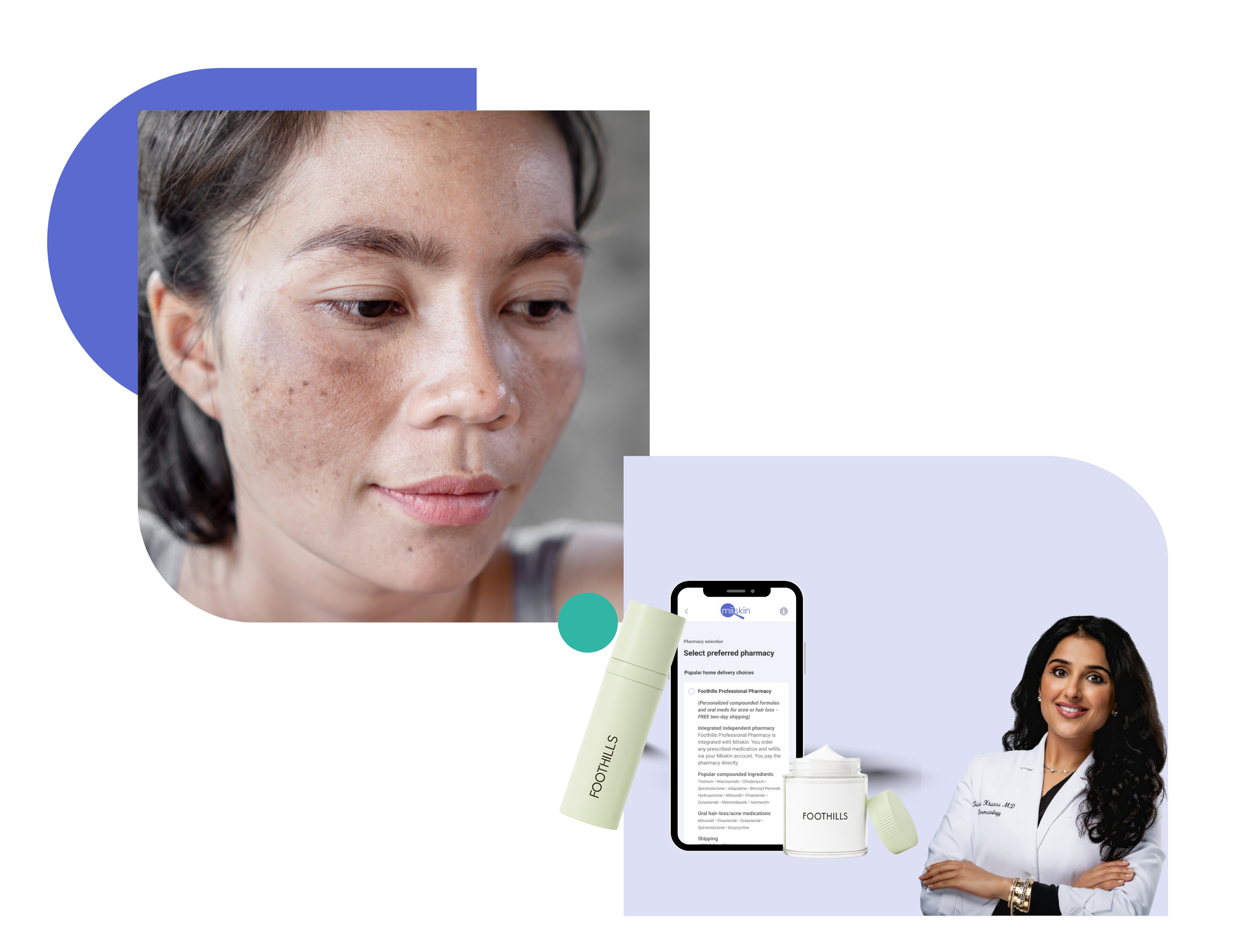 online hyperpigmentation treatment treatment of hyperpigmentation online