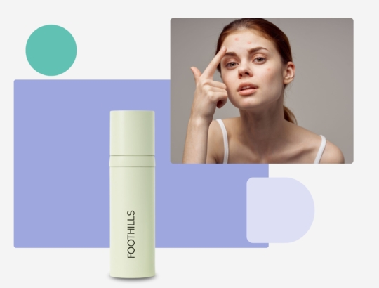 get a topical spironolactone formula