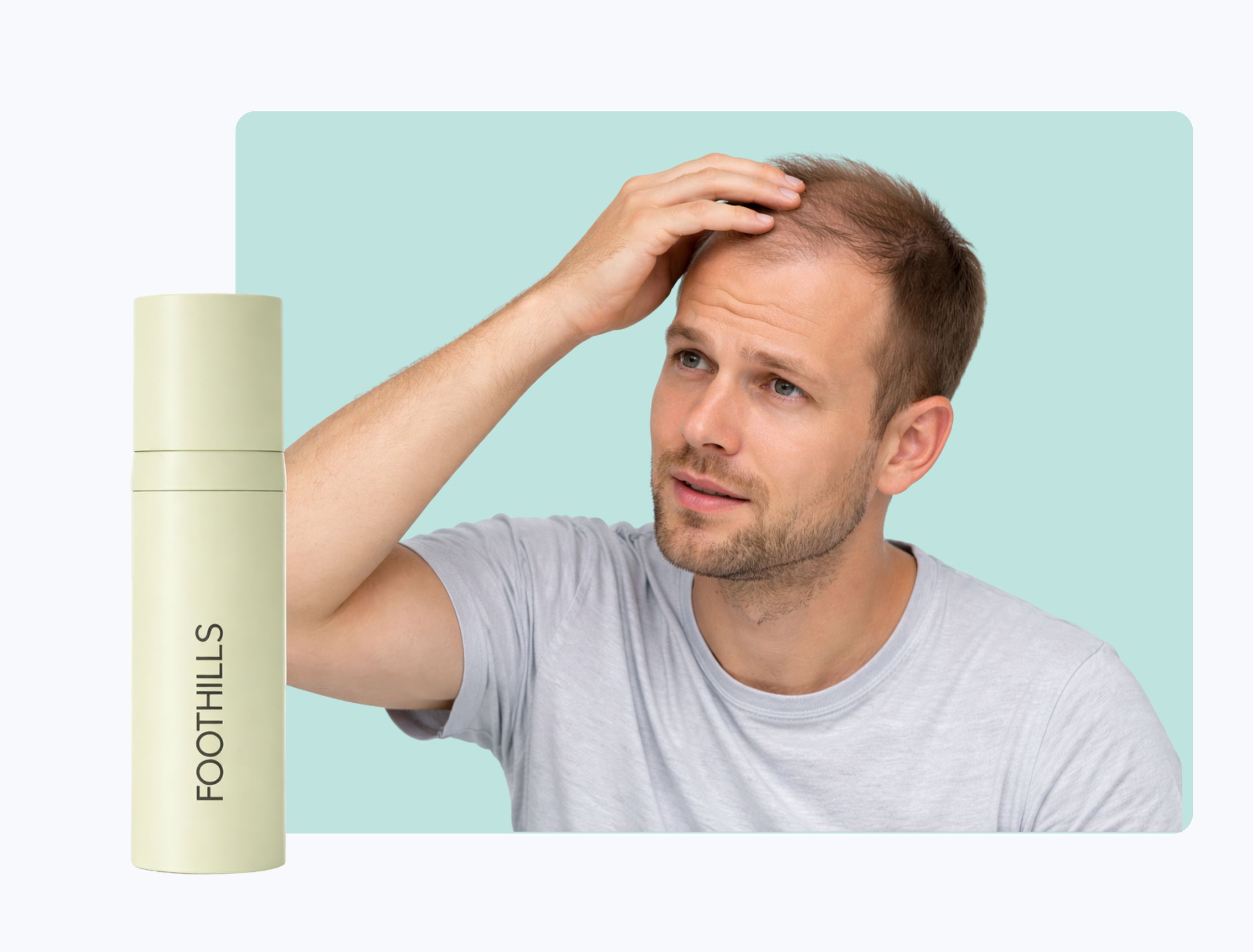 man presented with hair loss problems and foothills bottle of medication