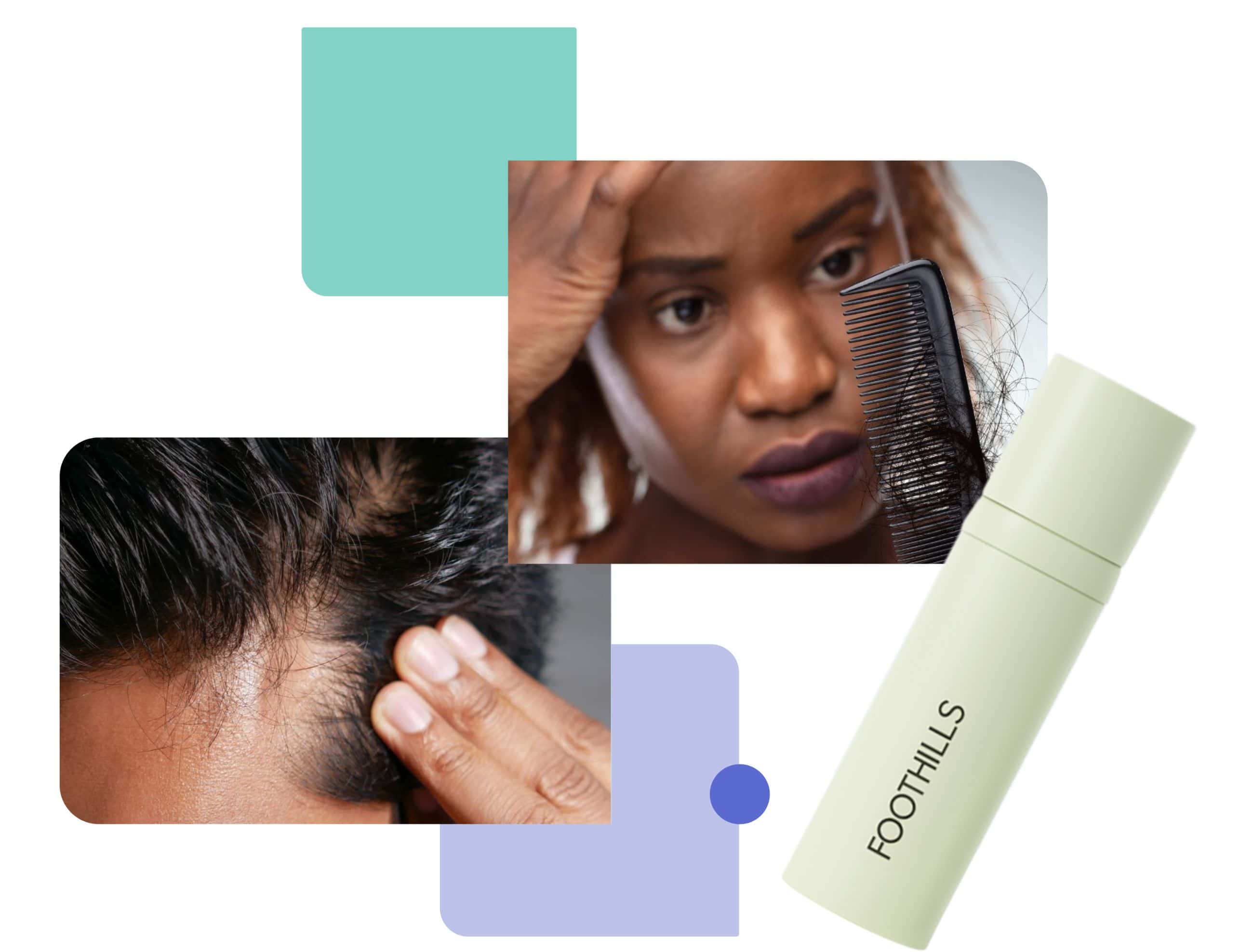 a man and a woman presented with hair loss problems nad foothills bottle of medication