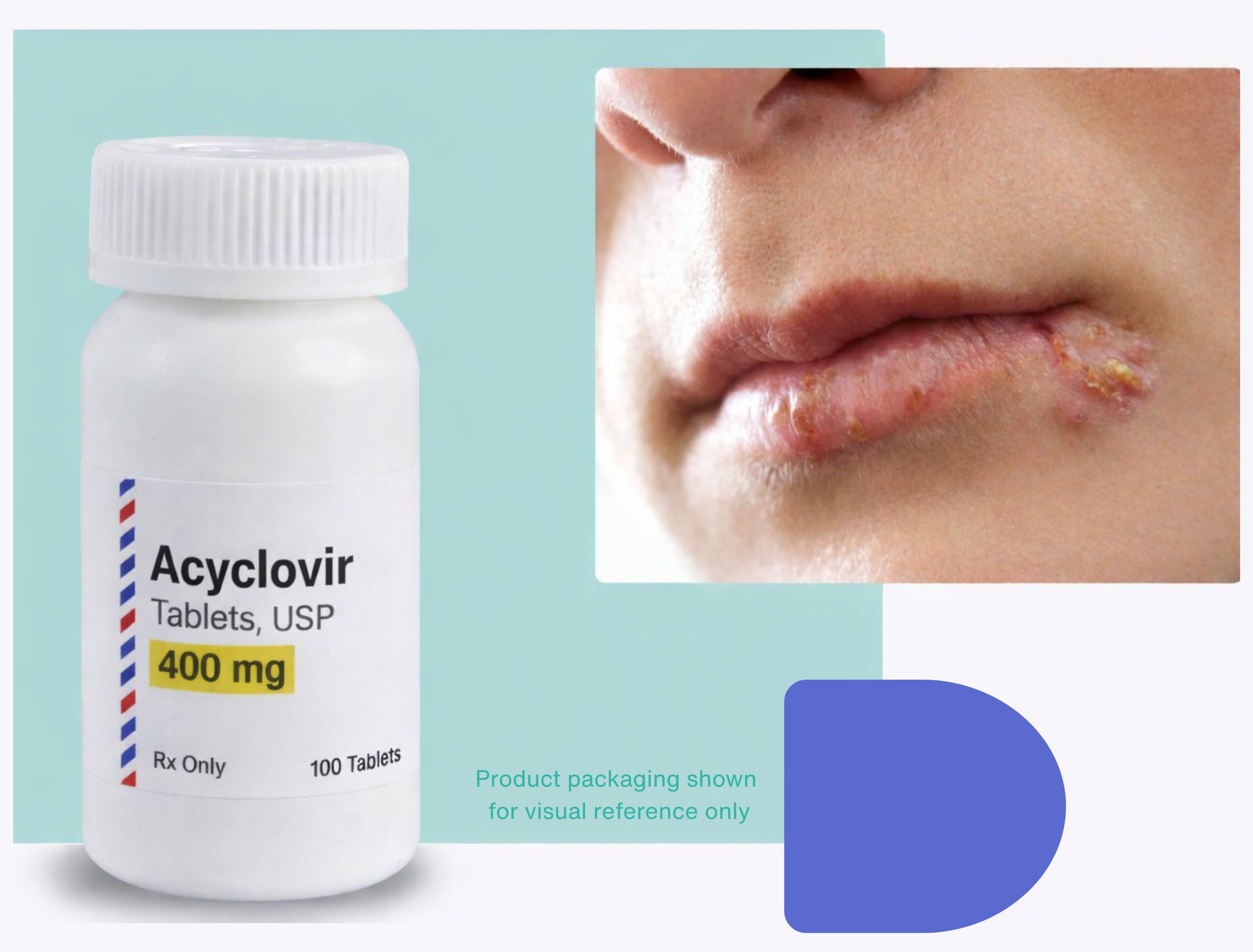 require acyclovir prescription