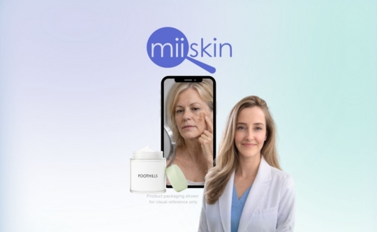 Hydroquinone and tretinoin for melasma and hyperpigmentation