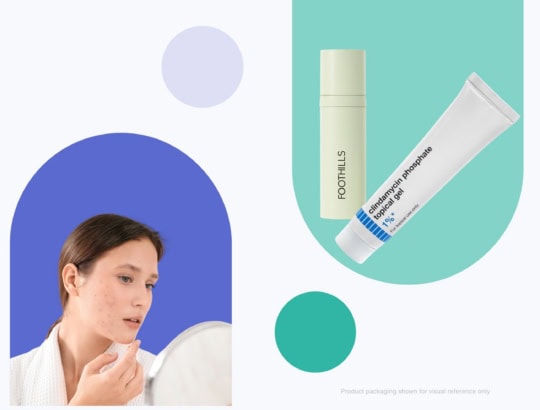 Collage showing a woman with acne, and a tube of foothills and clindamycin creams on a light background with abstract shapes.