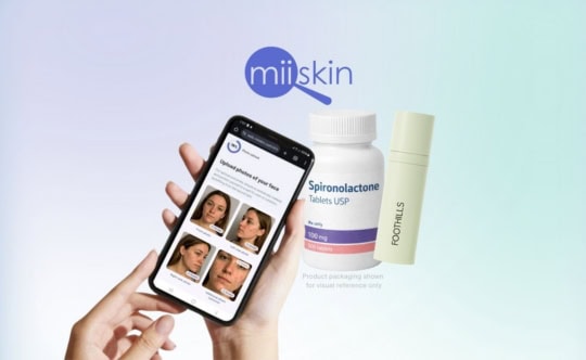 Smartphone displaying the Miiskin app with facial acne photo capture screens, shown next to a bottle of spironolactone tablets.