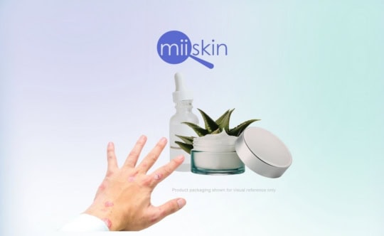 over the counter psoriasis creams