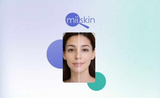 sallow and dull skin