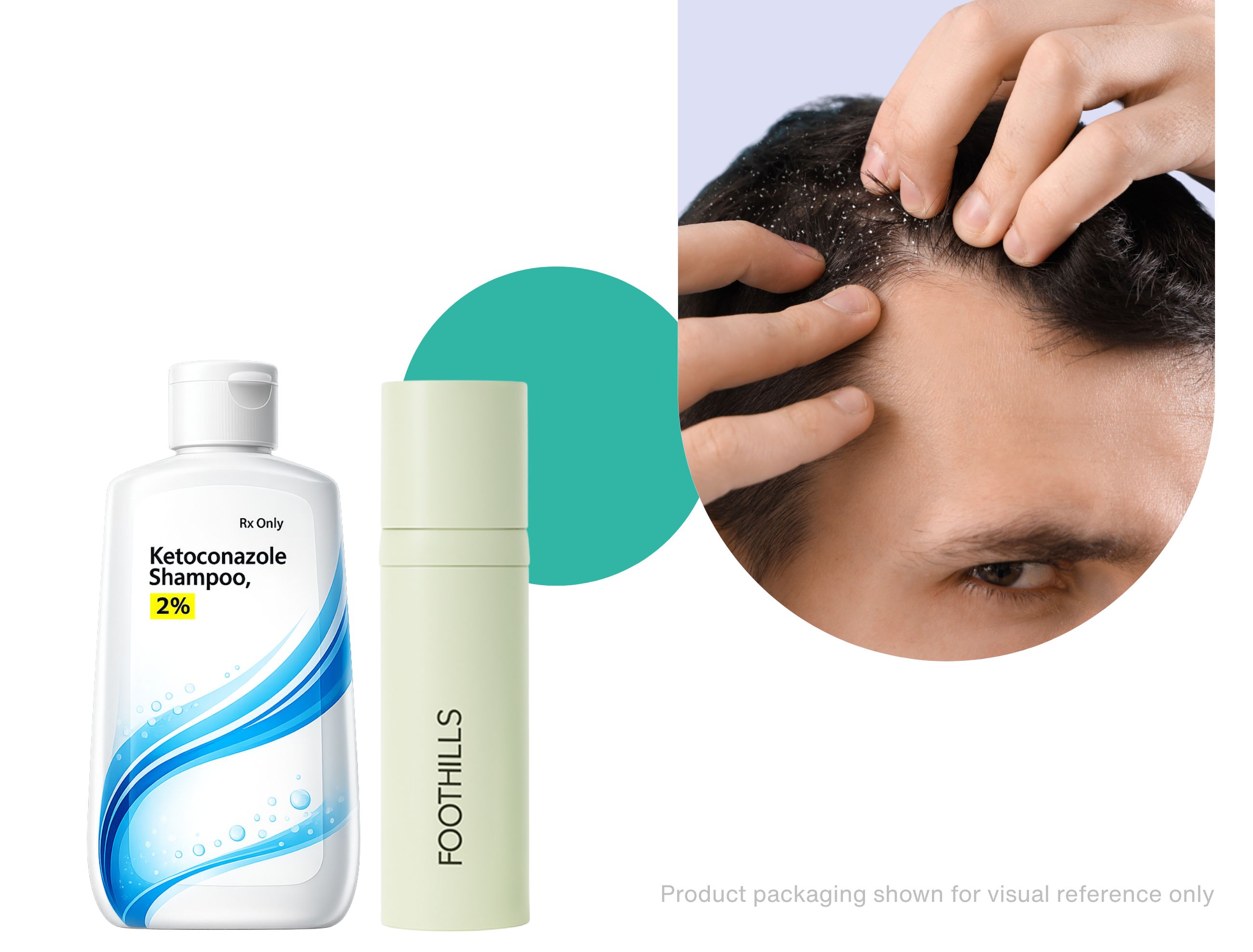 man with scalp yeast problem treating skalp yeast with nizoral shampoo