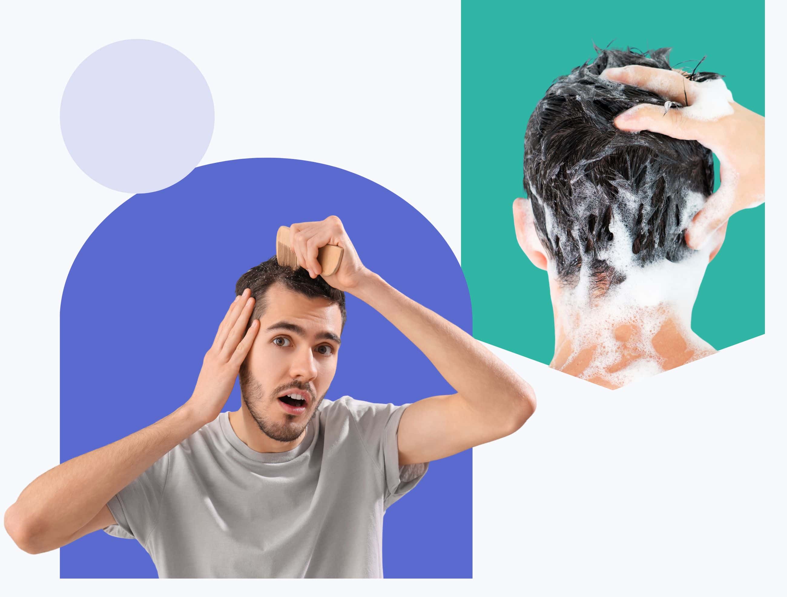 dandruff prescriptions