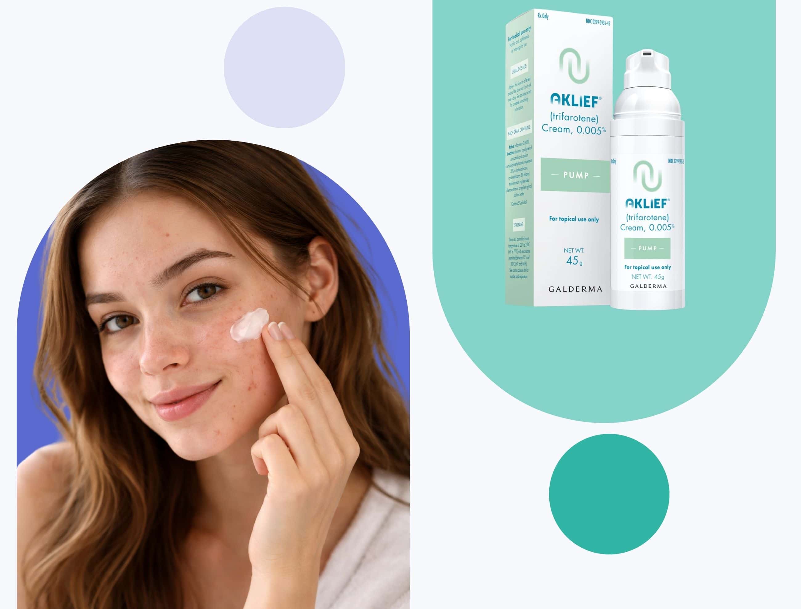 aklief cream for acne Woman applying acne treatment to her face. On one side, aklief cream