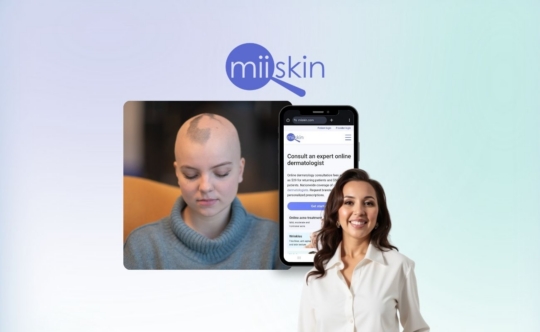 stop alopecia areata from spreading