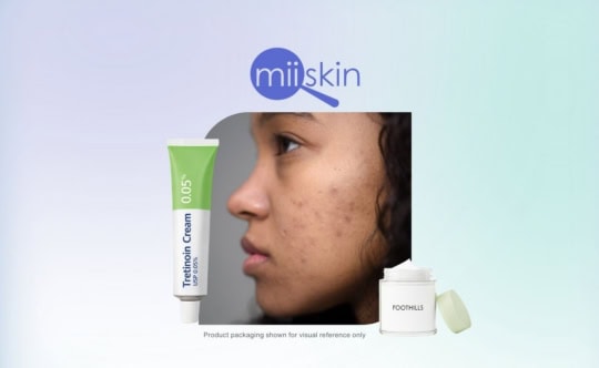 woman with acne scars next to a tretinoin cream and a compounded cream from foothills pharmacy