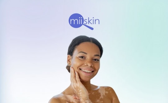 how to get vitiligo treatment