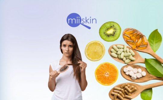 vitamin deficiency causing hair loss