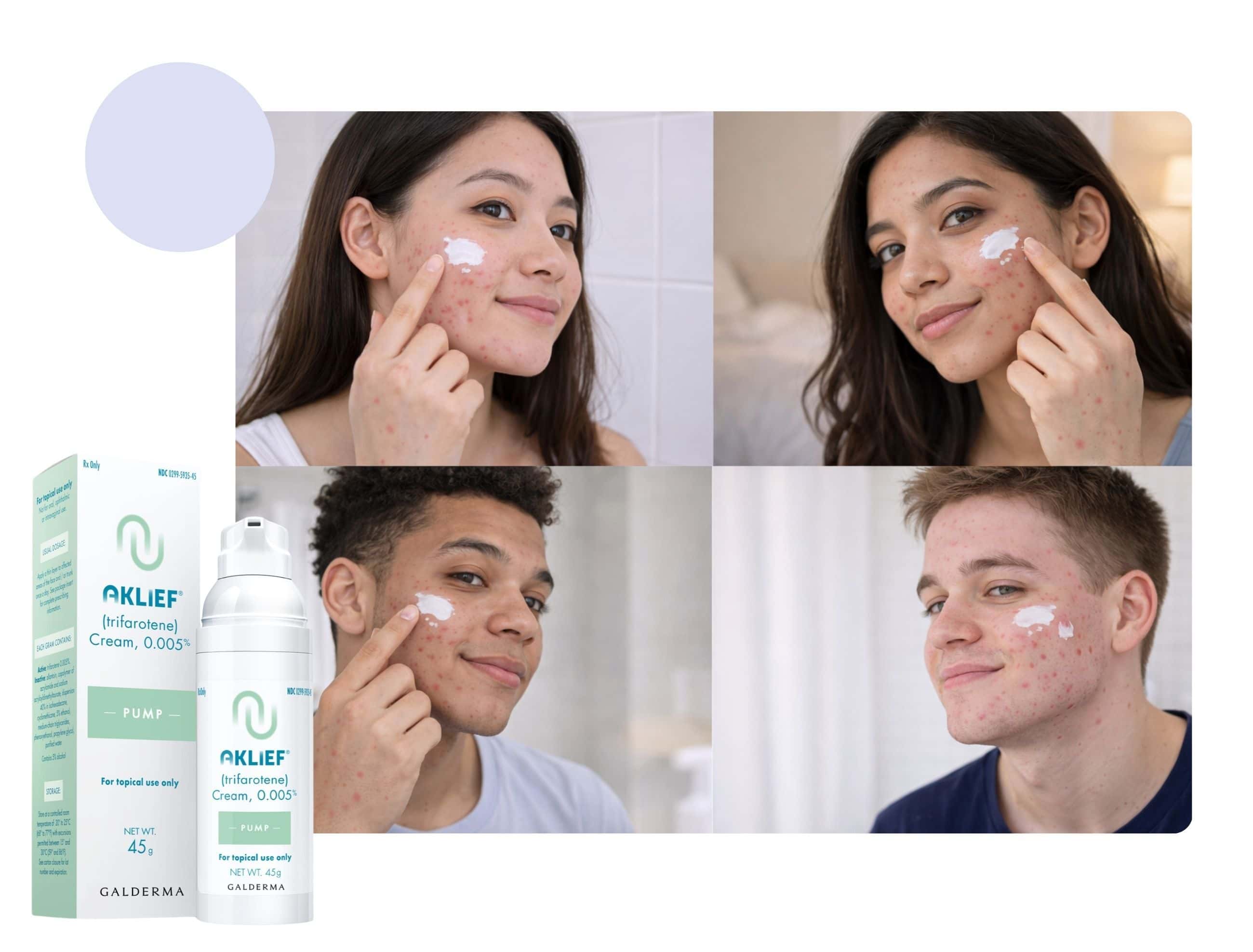 aklief treatment why is aklief becoming so popular