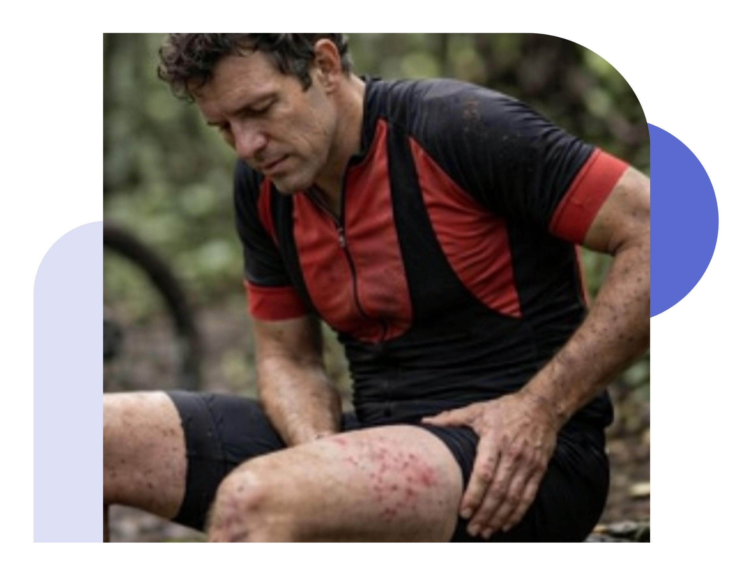 symptoms of jock itch cyclist with signs of jock itch