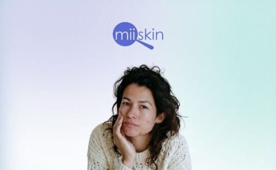 woman with acne to represent aklief 0.005 topical cream
