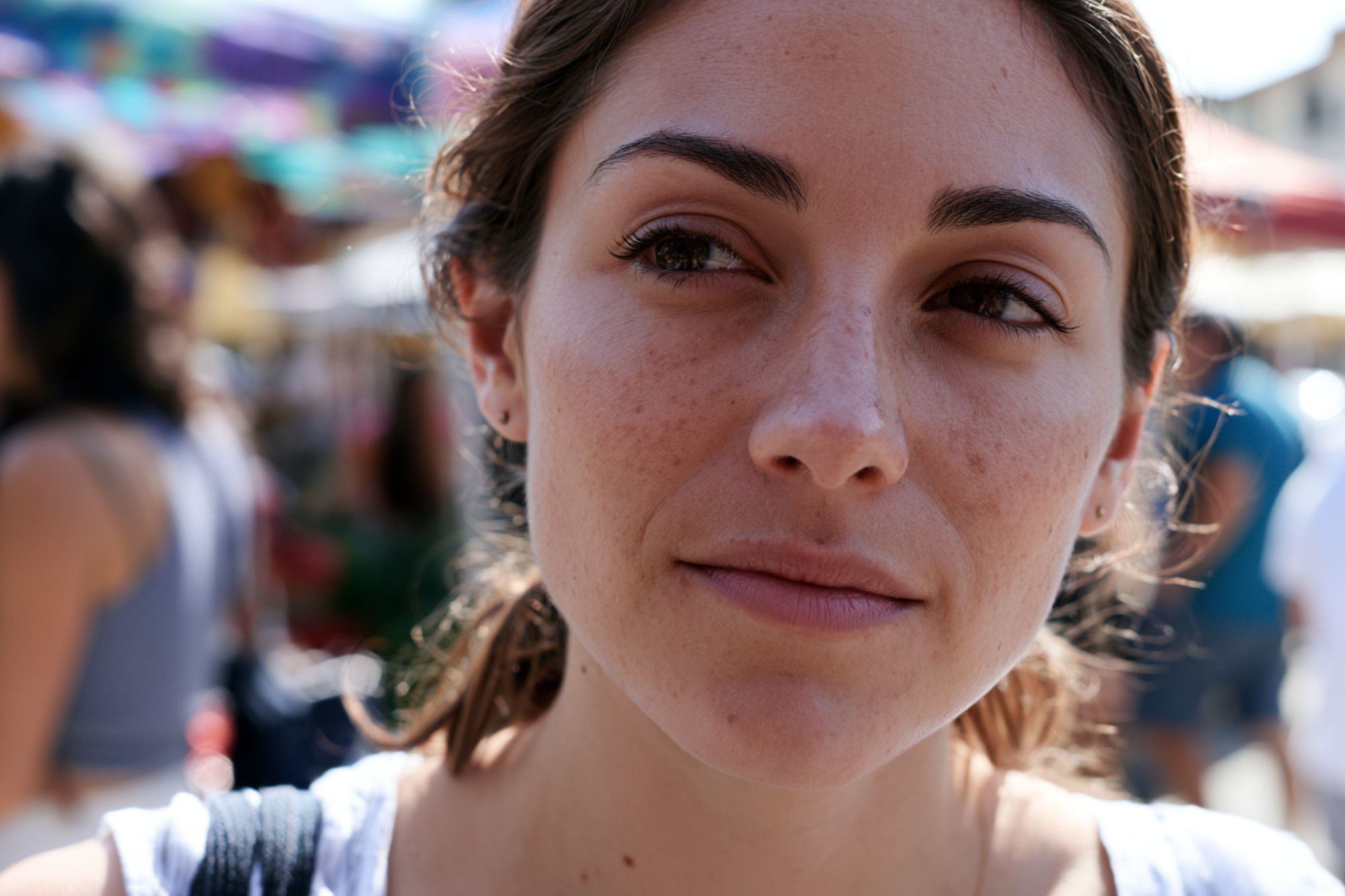 treatment of hyperpigmentation online