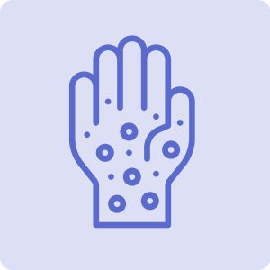 Atopic dermatitis