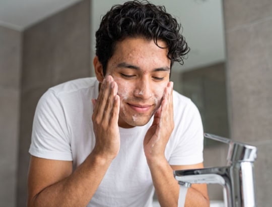 Man with acne washing his face