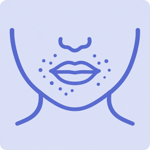 Perioral dermatitis