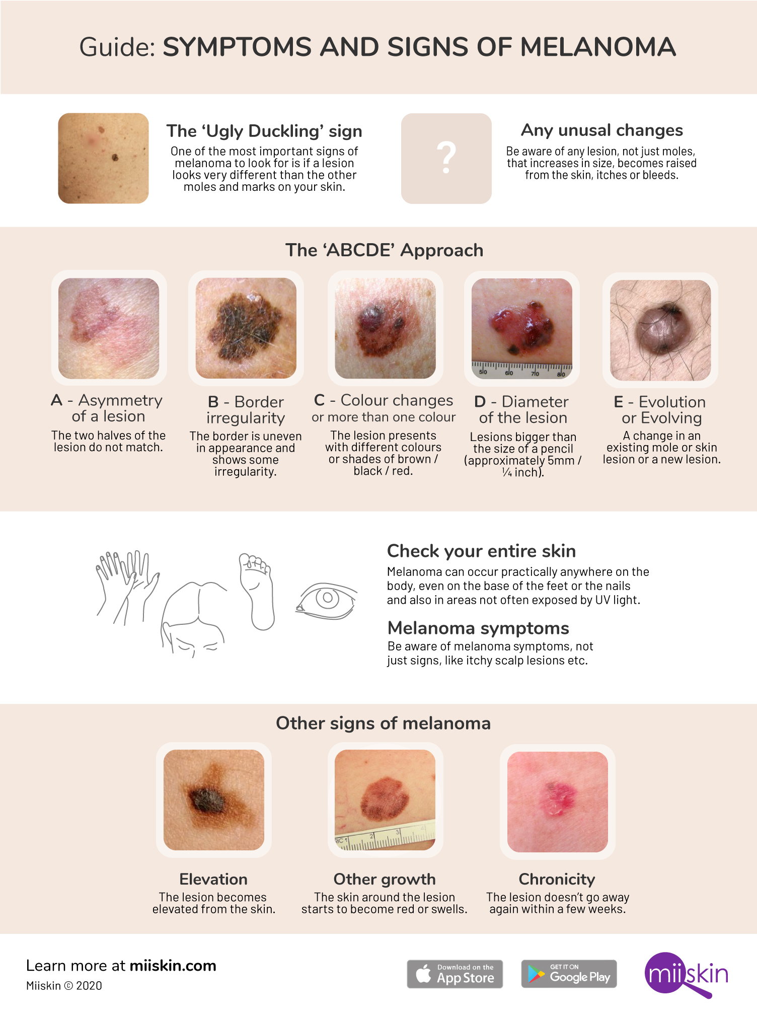 early signs of melanoma infographic early melanoma symptoms and signs