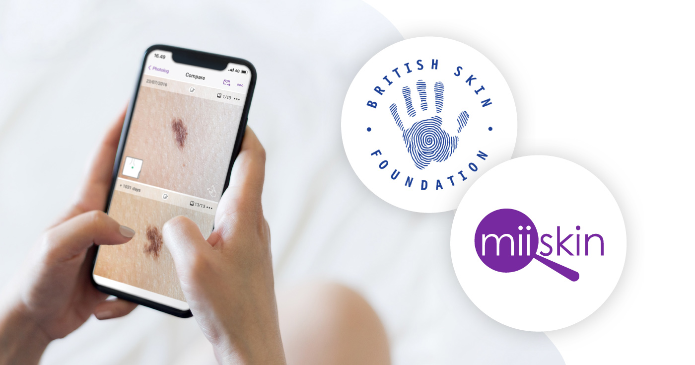 Miiskin and British Skin Foundation